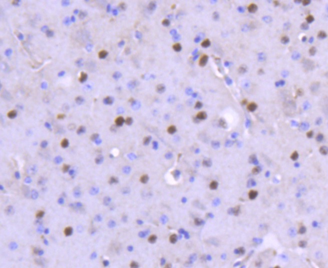 Anti-FOSB Antibody (8O342)