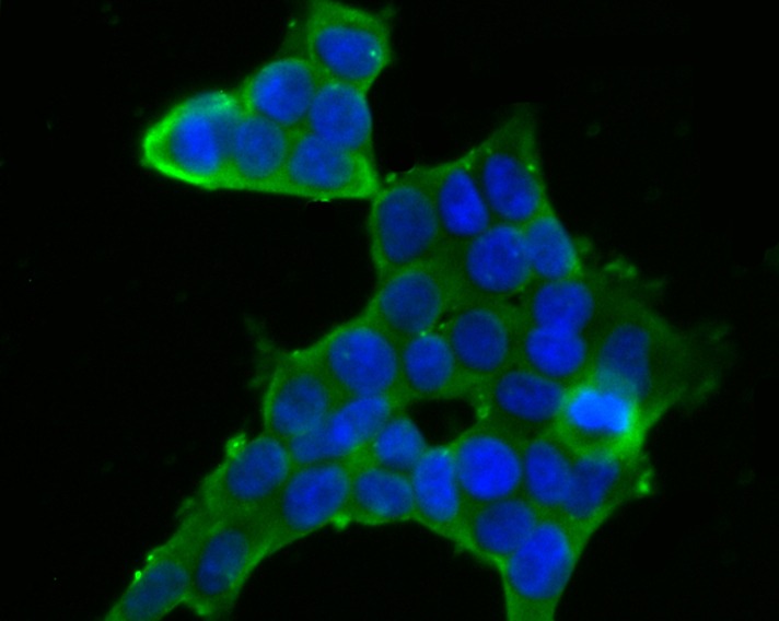 Anti-FKBP4 Antibody (1H771)