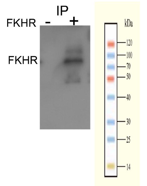 Anti-Phospho-FKHR (Ser256) Polyclonal Antibody