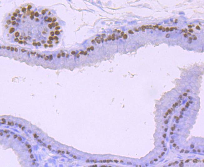 Anti-FOXA1 Antibody (5M374)