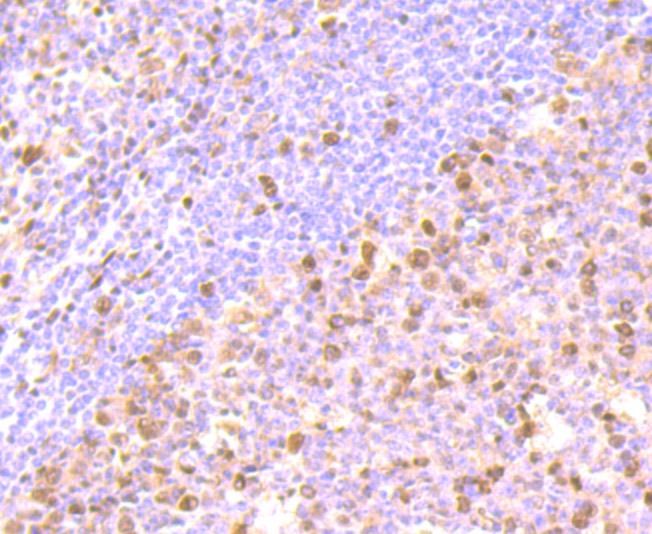 Anti-FKBP51 Antibody (6E556)