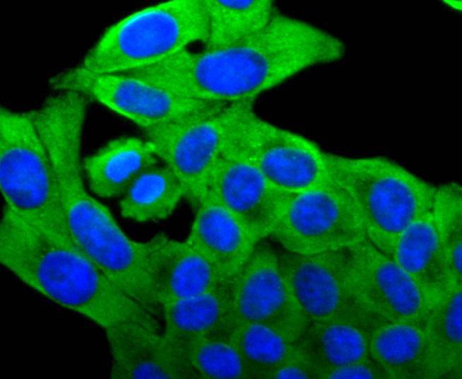 Anti-FOXO4 Antibody (5M471)
