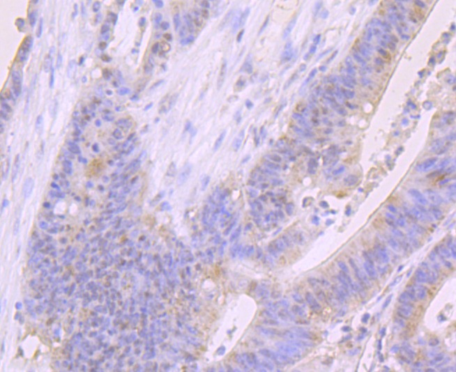 Anti-FOXP1 Antibody (1G20)