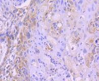 Anti-FOXO4 Antibody (2X512)