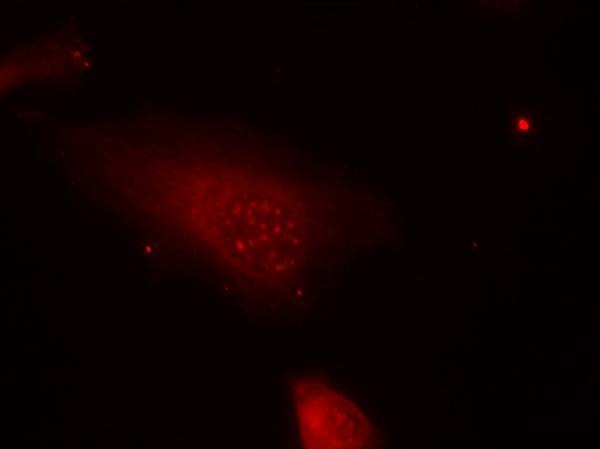 Anti-Phospho-FKHR (Ser319) Polyclonal Antibody