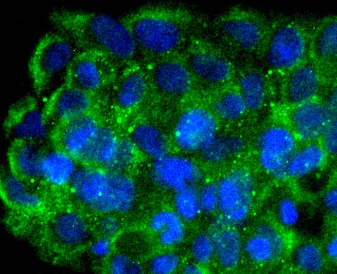 Anti-FNTB Antibody (1O812)