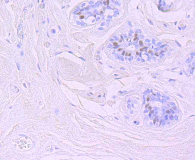 Anti-FOXA1 Antibody (5M374)