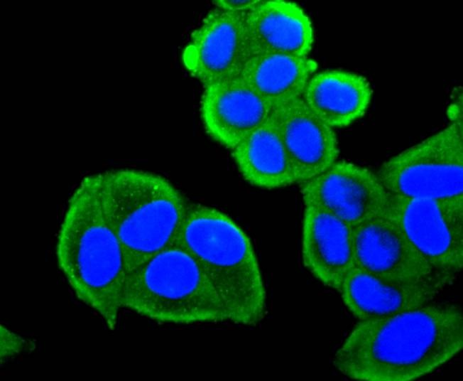 Anti-FOXO4 Antibody (5M471)