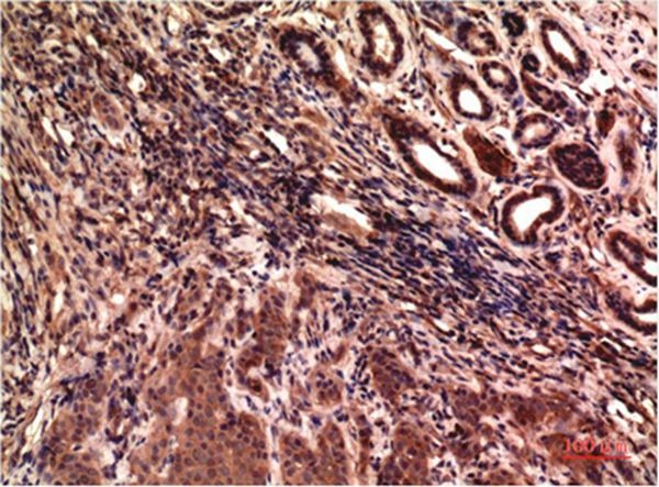 Anti-Gamma Tubulin Antibody (9N701)