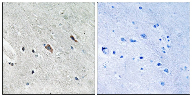 Anti-Phospho-GAB2 (Tyr643) Polyclonal Antibody