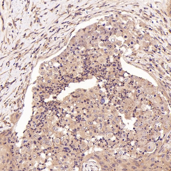 Anti-FGFR1 Antibody (9Z597)