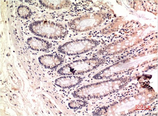 Anti-Gamma Tubulin Antibody (8J368)
