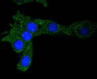 Anti-Ferritin light chain Antibody (6N112)