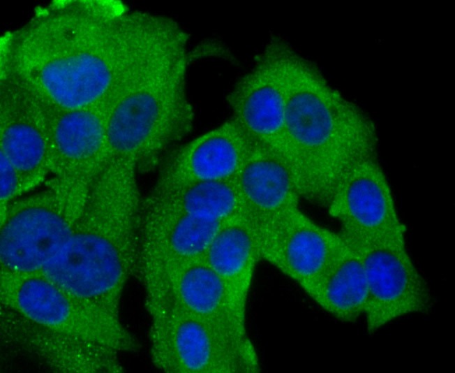 Anti-GAB1 Antibody (4I330)