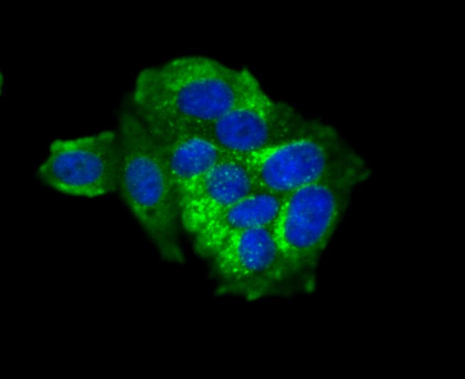 Anti-Fragilis/IFITM3 Antibody (5N399)