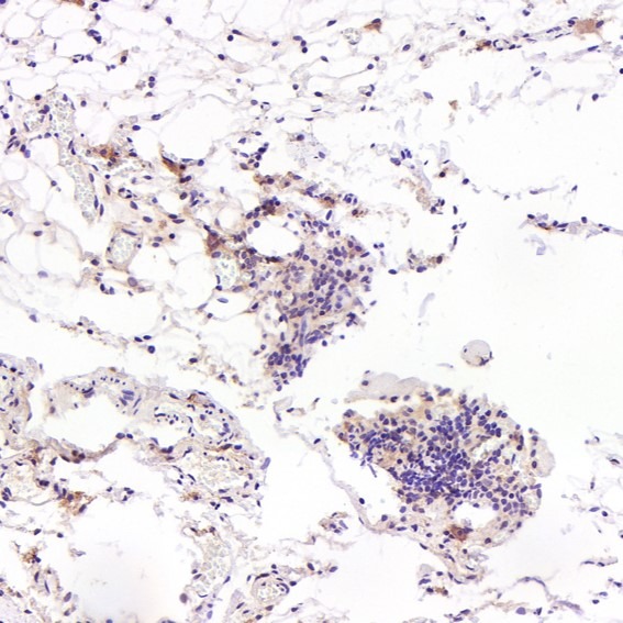Anti-FGFR1 Antibody (9Z597)