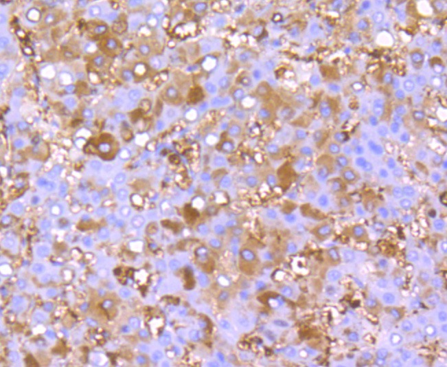 Anti-FGF-21 Antibody (3Q948)