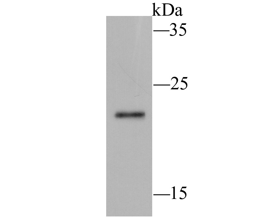 Anti-Ferritin light chain Antibody (6N112)