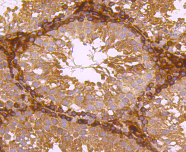 Anti-Ferritin light chain Antibody (9K512)