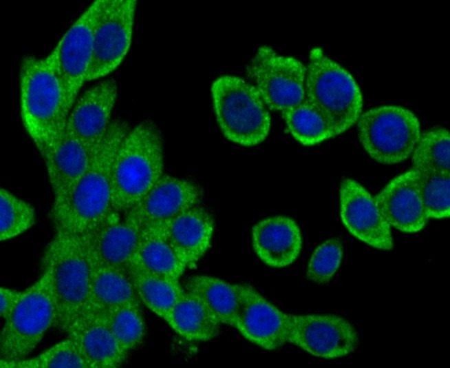 Anti-GAB1 Antibody (4I330)