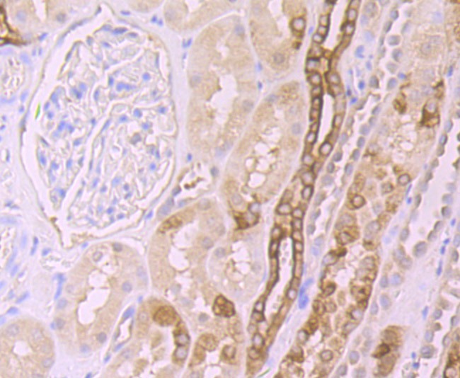 Anti-Frizzled-8 Antibody (5A651)