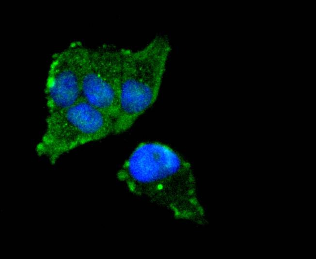 Anti-FOXO3 Antibody (6R502)