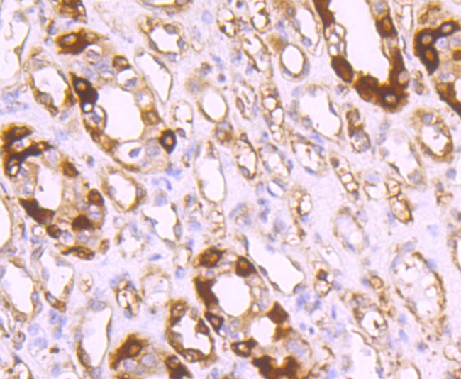 Anti-Ferritin light chain Antibody (9K512)