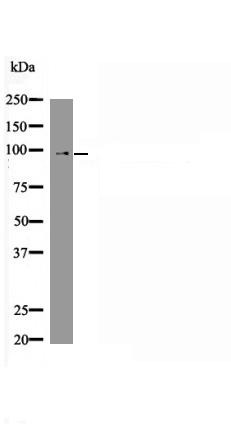 Anti-Phospho-FOXO3 (Ser574) Polyclonal Antibody