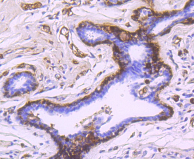 Anti-SNCG Antibody (8D869)