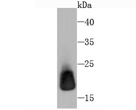 Anti-Ferritin light chain Antibody (9K512)