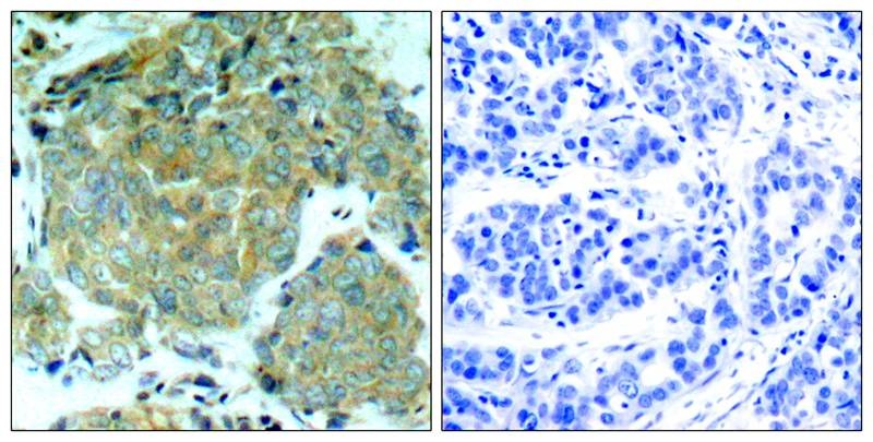 Anti-Phospho-EIF2S1 (Ser51) Polyclonal Antibody 2