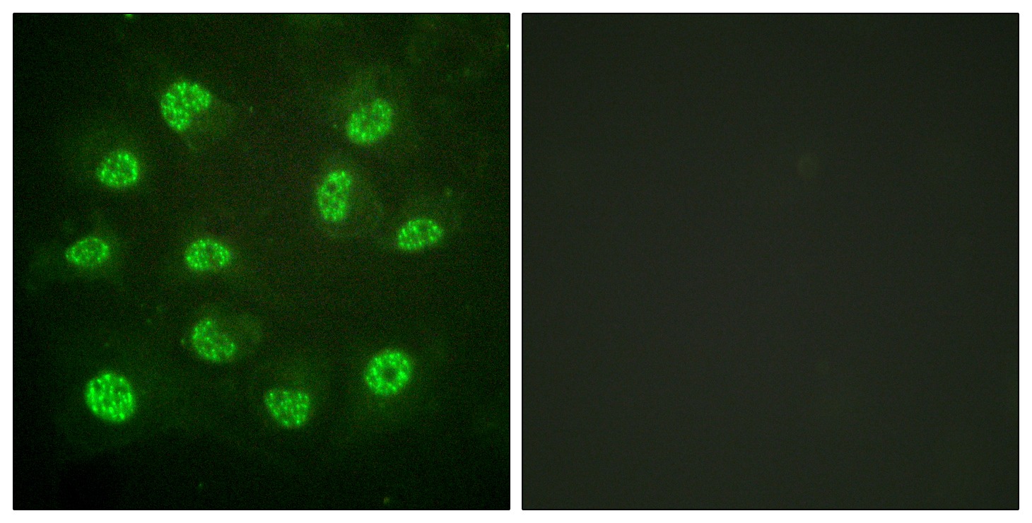 Anti-Phospho-ER beta (Ser105) Polyclonal Antibody