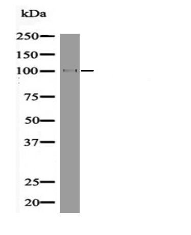 Anti-Phospho-EZH2 (Thr367) Polyclonal Antibody