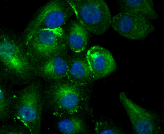 Anti-TFF1 Antibody (6D947)