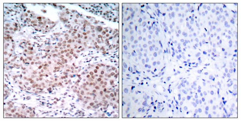 Anti-Phospho-ER alpha (Ser104) Polyclonal Antibody