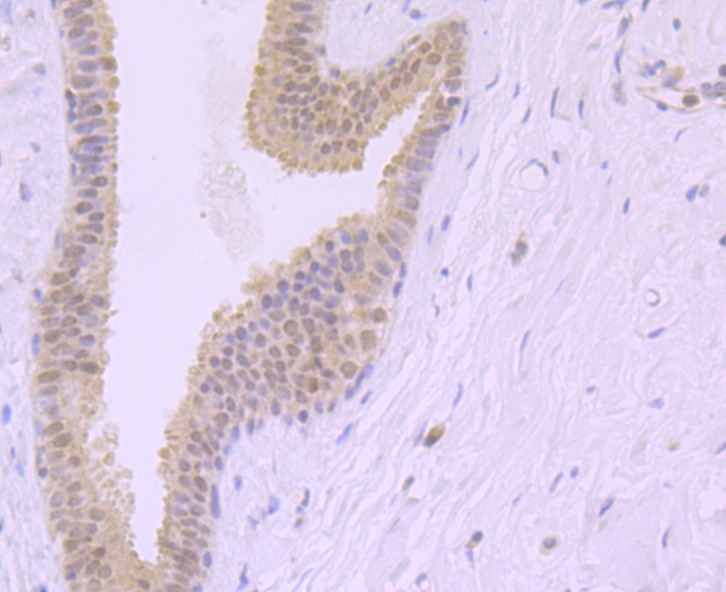 Anti-Exportin-5 Antibody (6J749)