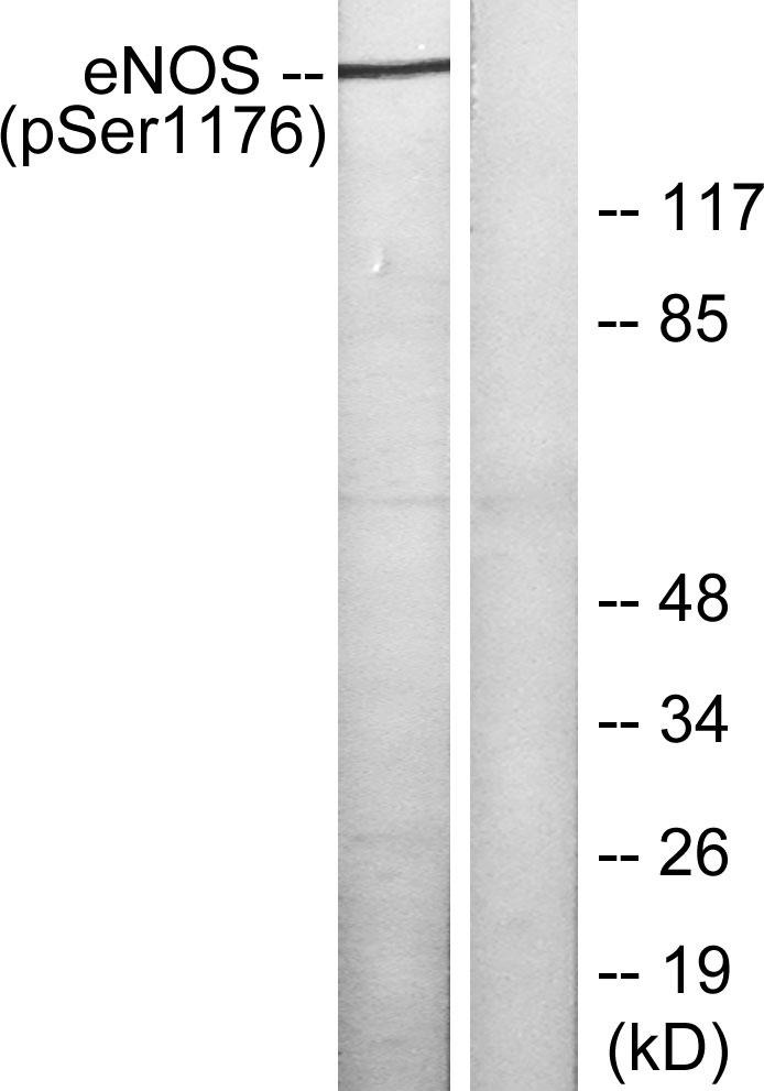 Anti-Phospho-eNOS (Ser1177) Polyclonal Antibody 2