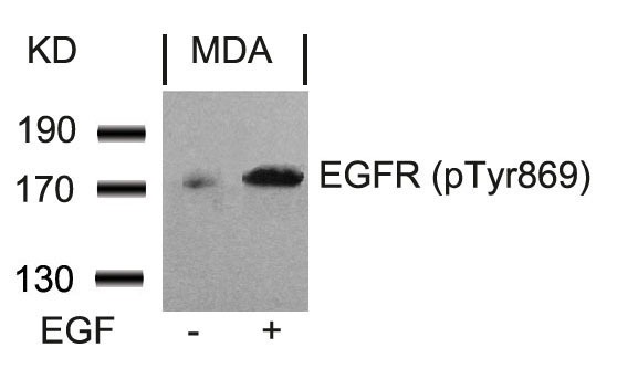 Anti-Phospho-EGFR (Tyr869) Polyclonal Antibody