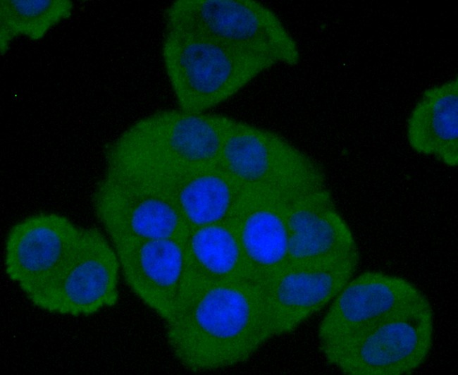 Anti-Complement factor H/CFH Antibody (2X509)