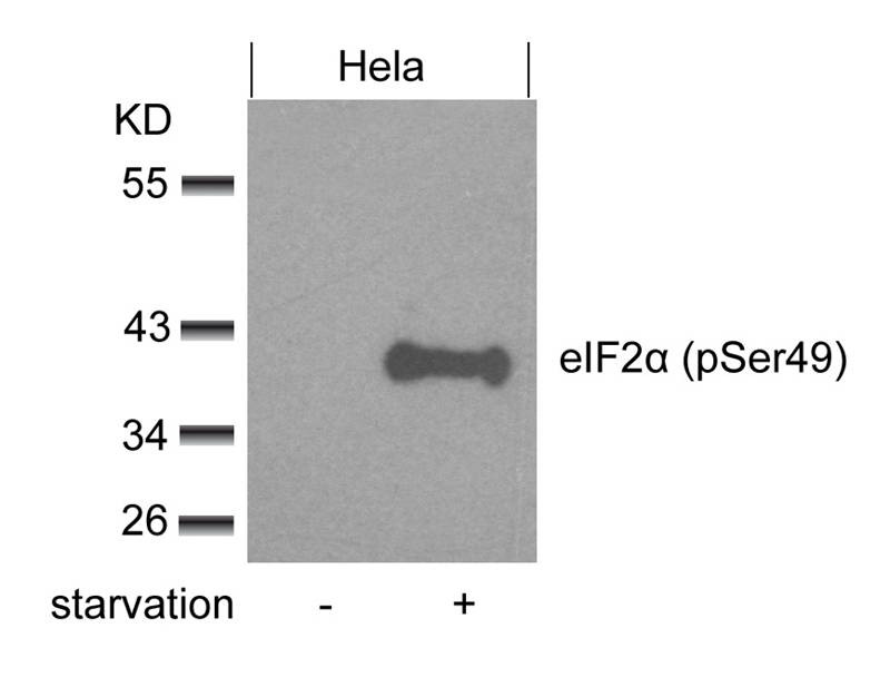 Anti-Phospho-EIF2S1 (Ser49) Polyclonal Antibody
