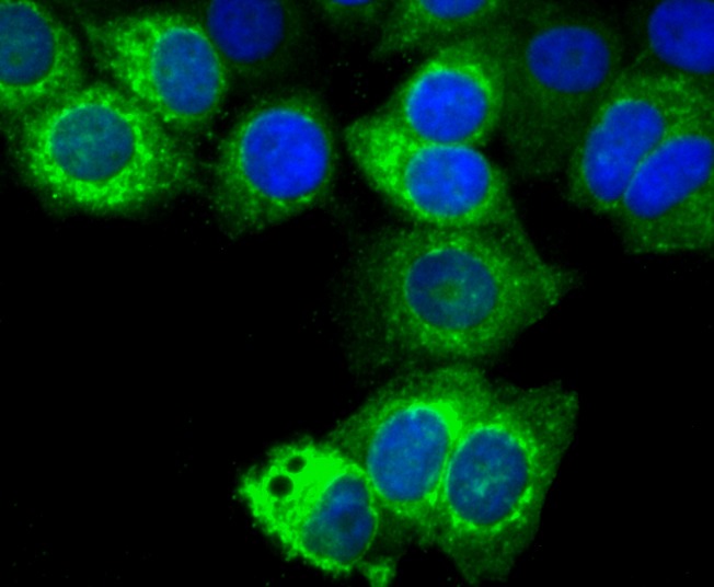 Anti-TFF1 Antibody (6D947)