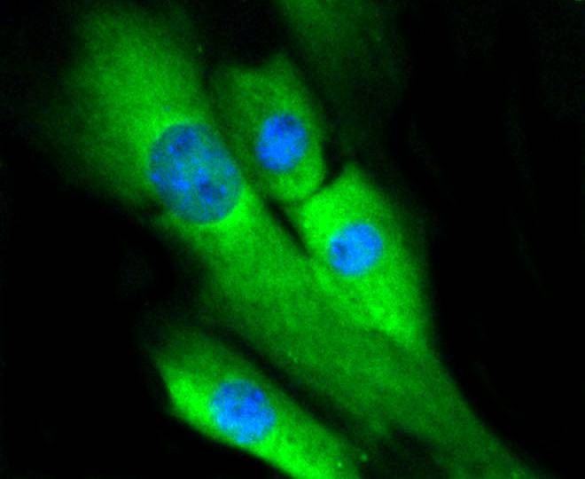 Anti-MAPK3/1 Antibody (1G244)