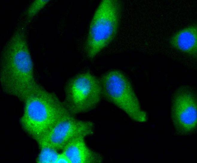 Anti-MAPK3/1 Antibody (1G244)