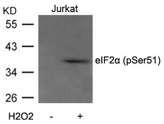 Anti-Phospho-EIF2S1 (Ser51) Polyclonal Antibody 2