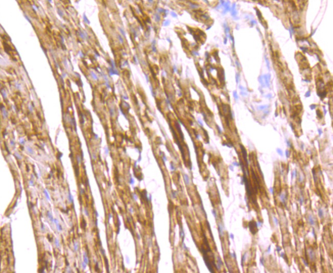 Anti-FABP3 Antibody (7G722)