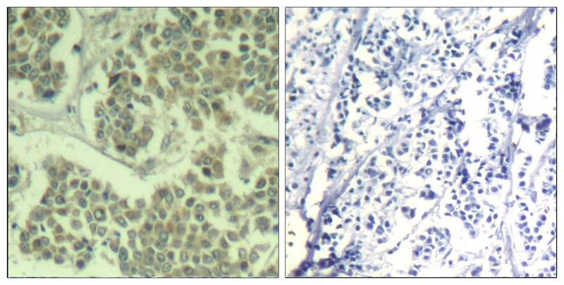Anti-Phospho-EIF2S1 (Ser49) Polyclonal Antibody