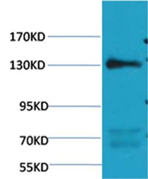 Anti-eNOS Antibody (8V329)