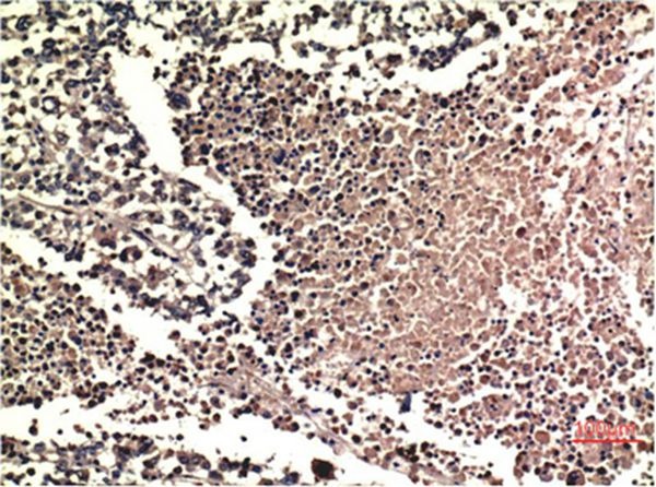 Anti-MAPK3/1 Antibody (7H964)