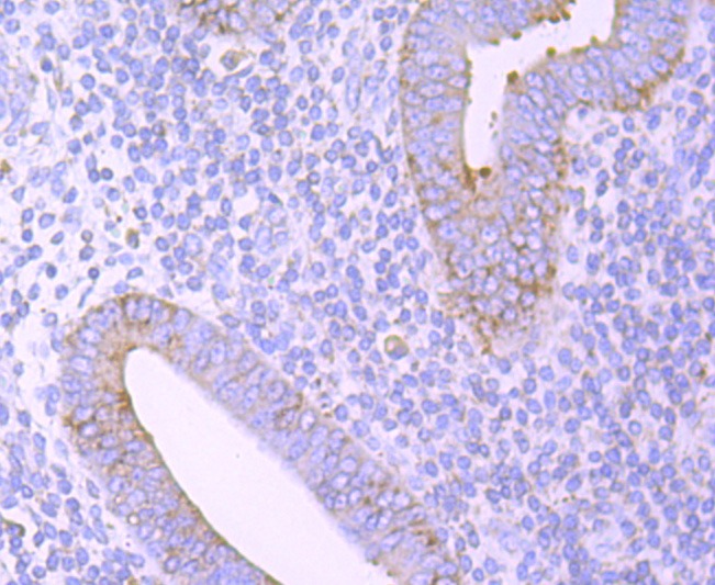 Anti-PDIA3 Antibody (8V206)