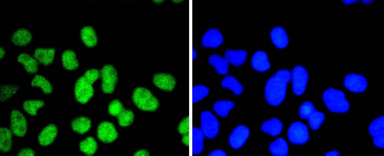 Anti-ELK1 Antibody (1X79)